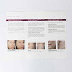 Deka SMARTXIDE DOT Patient Brochures - Treatment / Procedure information *Qty 40