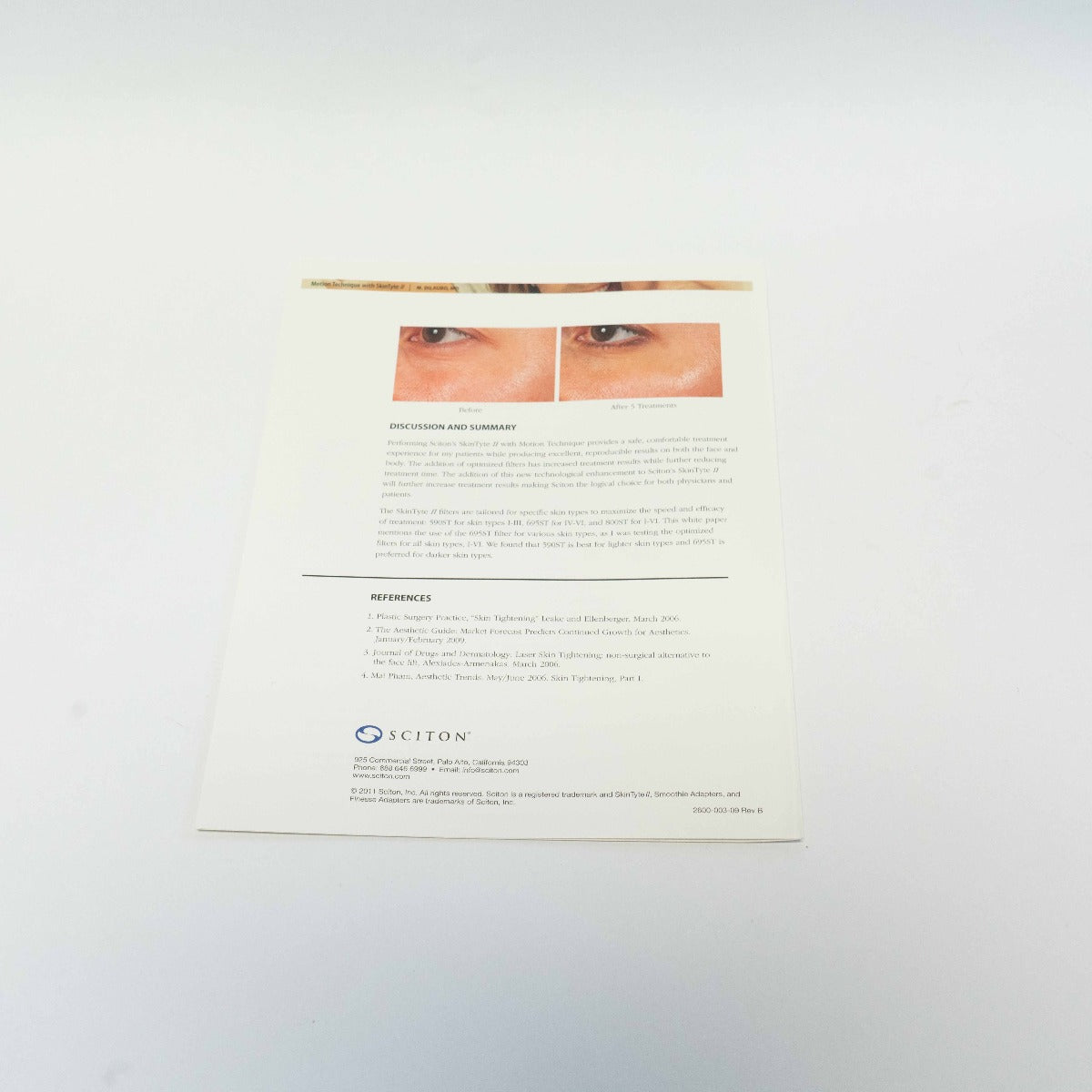 2011 Sciton White Paper - Motion Technique With SkinTyte II - 2600-003-09