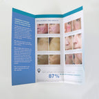 Sciton BBL Broadband Light 'Beautiful Skin With The Power of Light' Brochure x20
