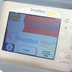 2008 Cynosure SmartLipo Triplex Body Sculpt System