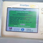2008 Cynosure SmartLipo Triplex Body Sculpt System