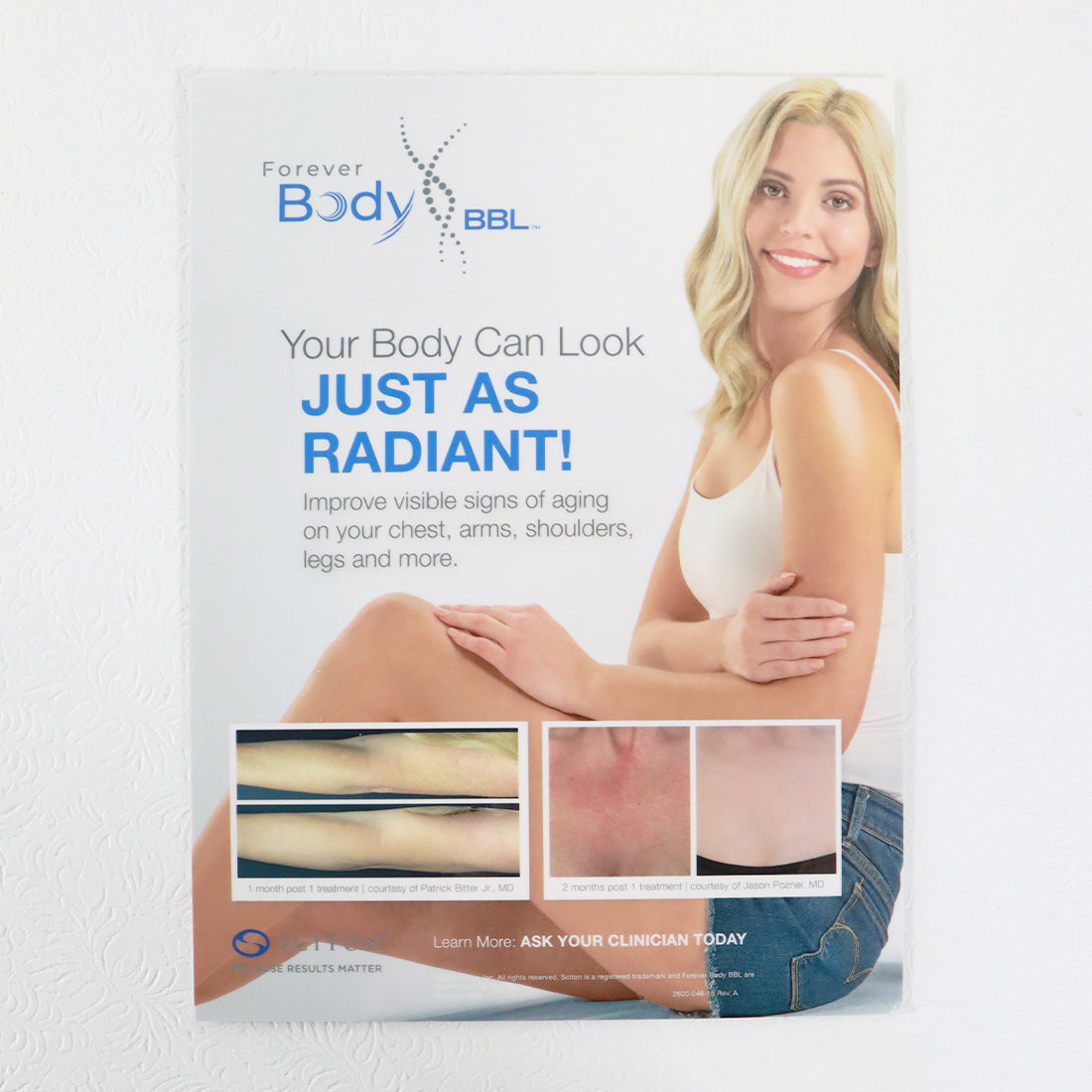 Sciton Forever Body BroadBand Light BBL Marketing Stand 2600-046-15