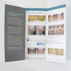 Sciton SkinTyte Love the Skin You're In Marketing Brochures 10pk