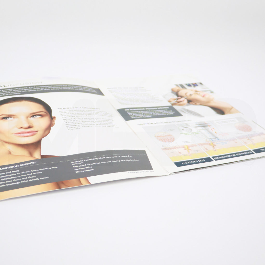 Envy Medical SilkPeel Dermal Infusion Info Packet
