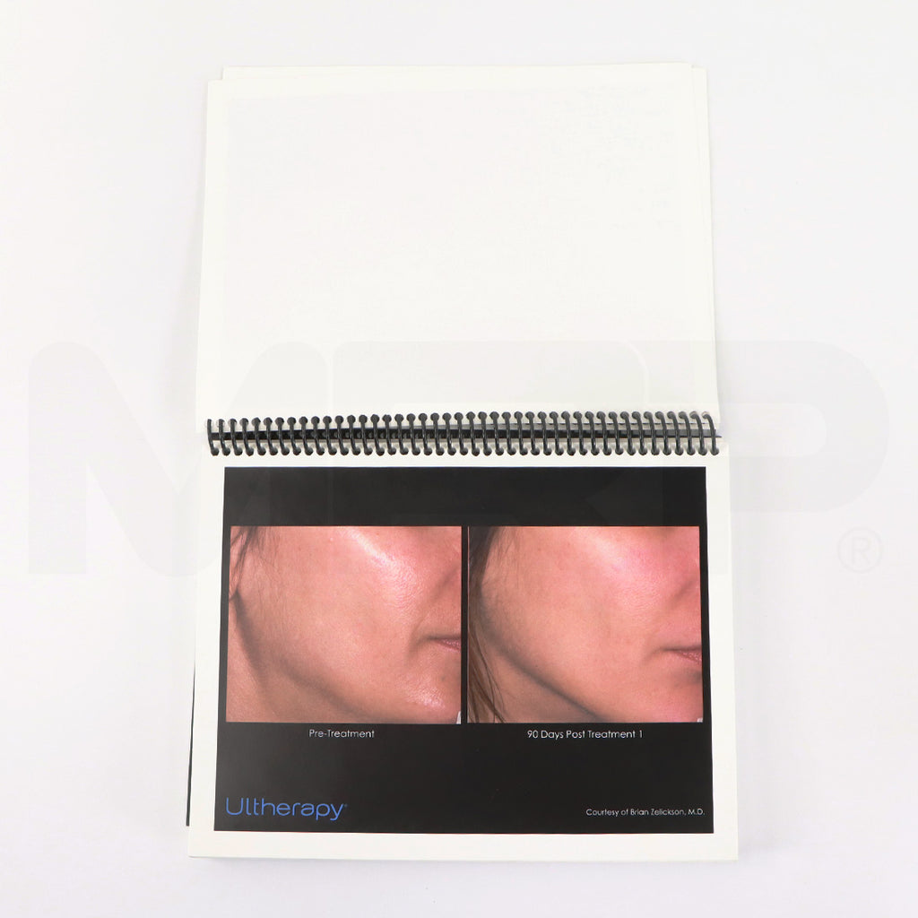 Ulthera Ultherapy Clinical Image Results Manual Open