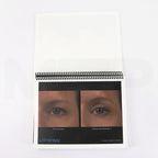 Ulthera Ultherapy Clinical Image Results Manual Page
