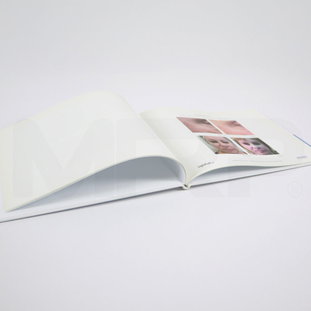 Aerolase ERA Laser Treatment Patient Before After Photos Book Office Marketing