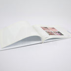 Aerolase ERA Laser Treatment Patient Before After Photos Book Office Marketing