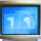 2013 Alma Accent VShape System Body Contour RF Pixel Large BiPolar Ultra