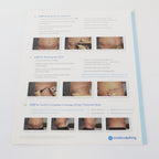 Zeltiq CoolSculpting Treatment To Transformation: Assessment Guide: Female