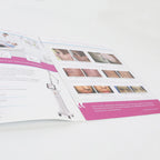 2016 Syneron Candela CO2RE The Complete CO2 Solution Brochure