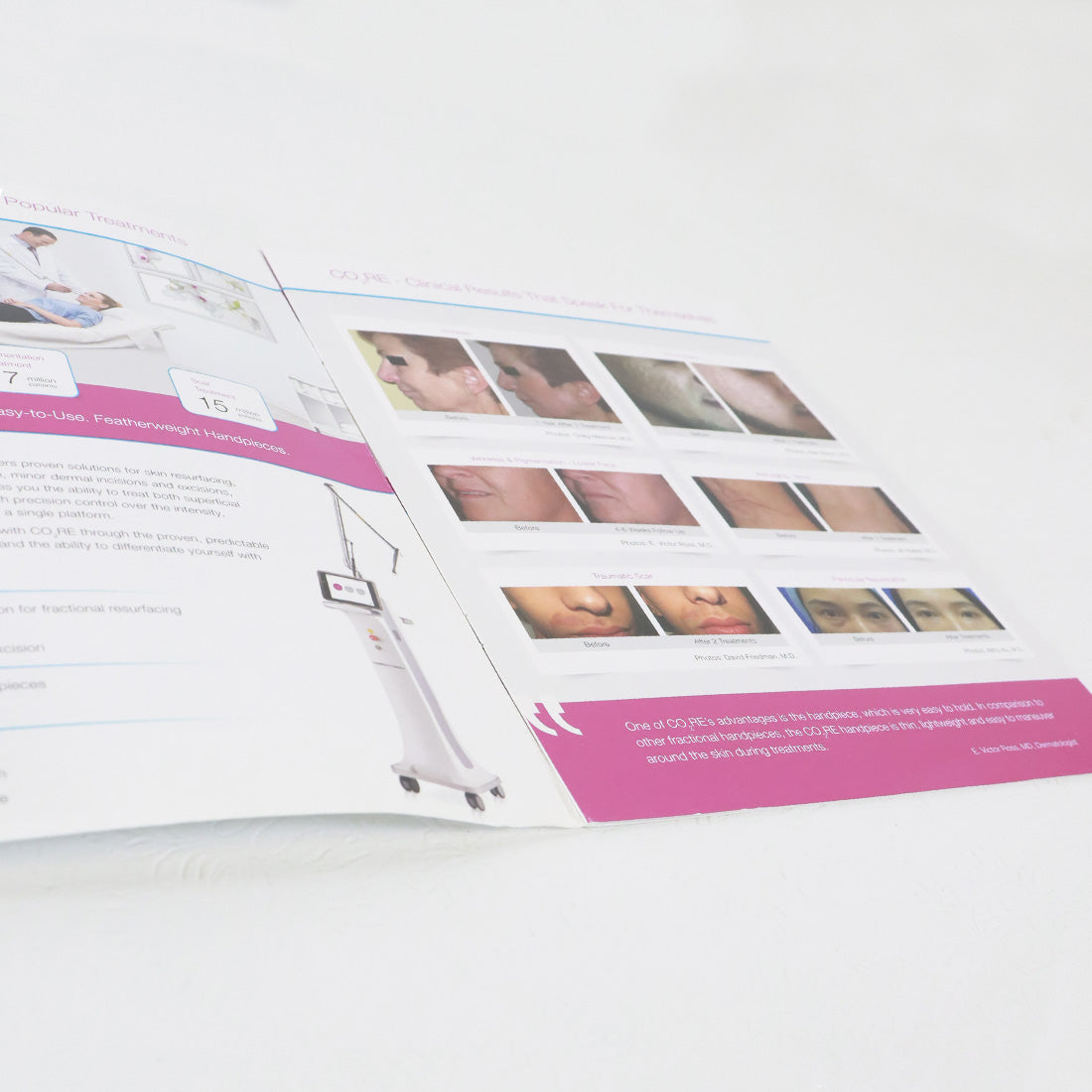 2016 Syneron Candela CO2RE The Complete CO2 Solution Brochure