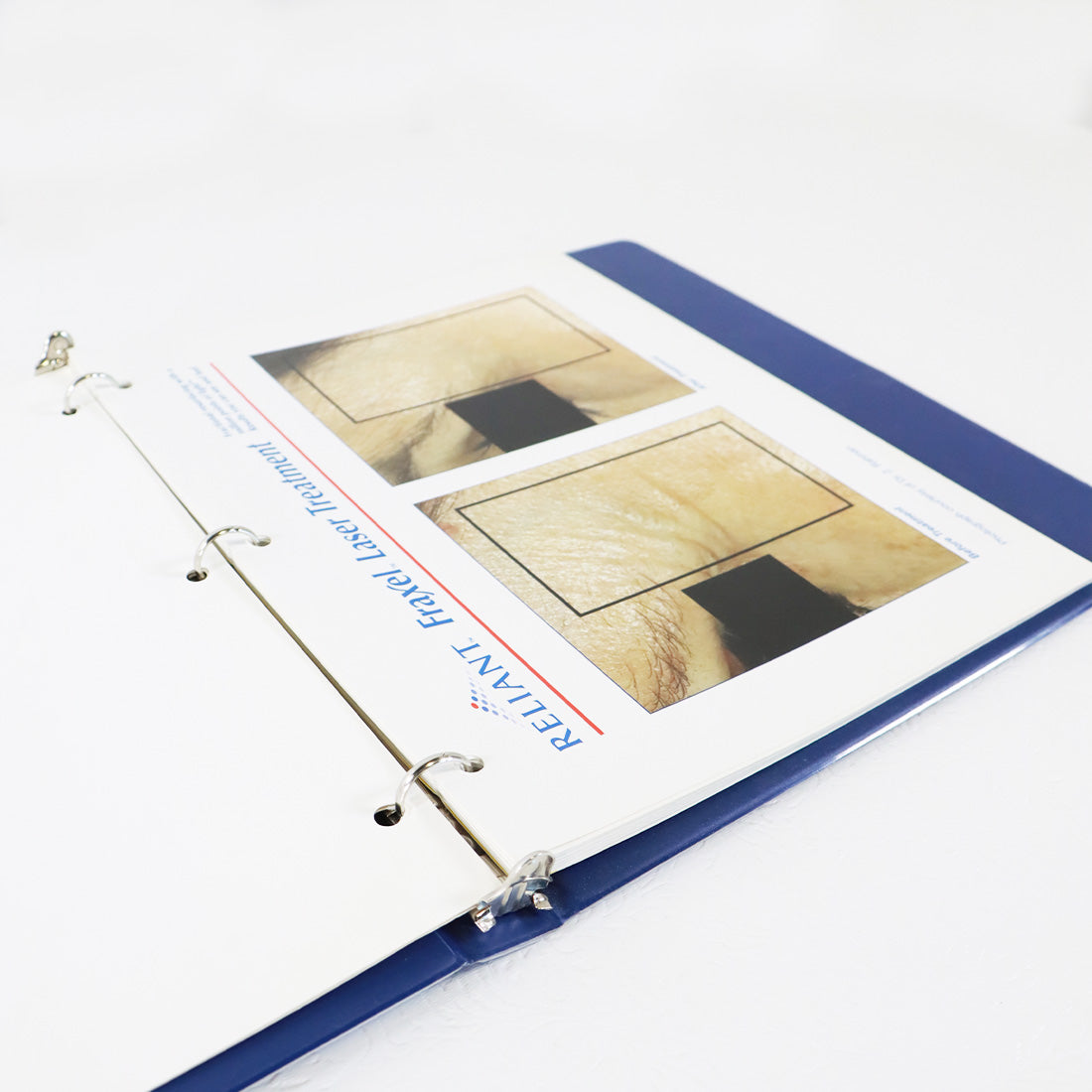 2005 Reliant Technologies Fraxel Laser Treatment Manual Guide 10-02233 Rev 1