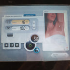 Alma Soprano ICE 810nm Diode Laser Hair Removal Platform – Certified Pre-Owned