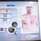 2019 Alma Soprano Ice Platinum Diode Hair Trio Removal System