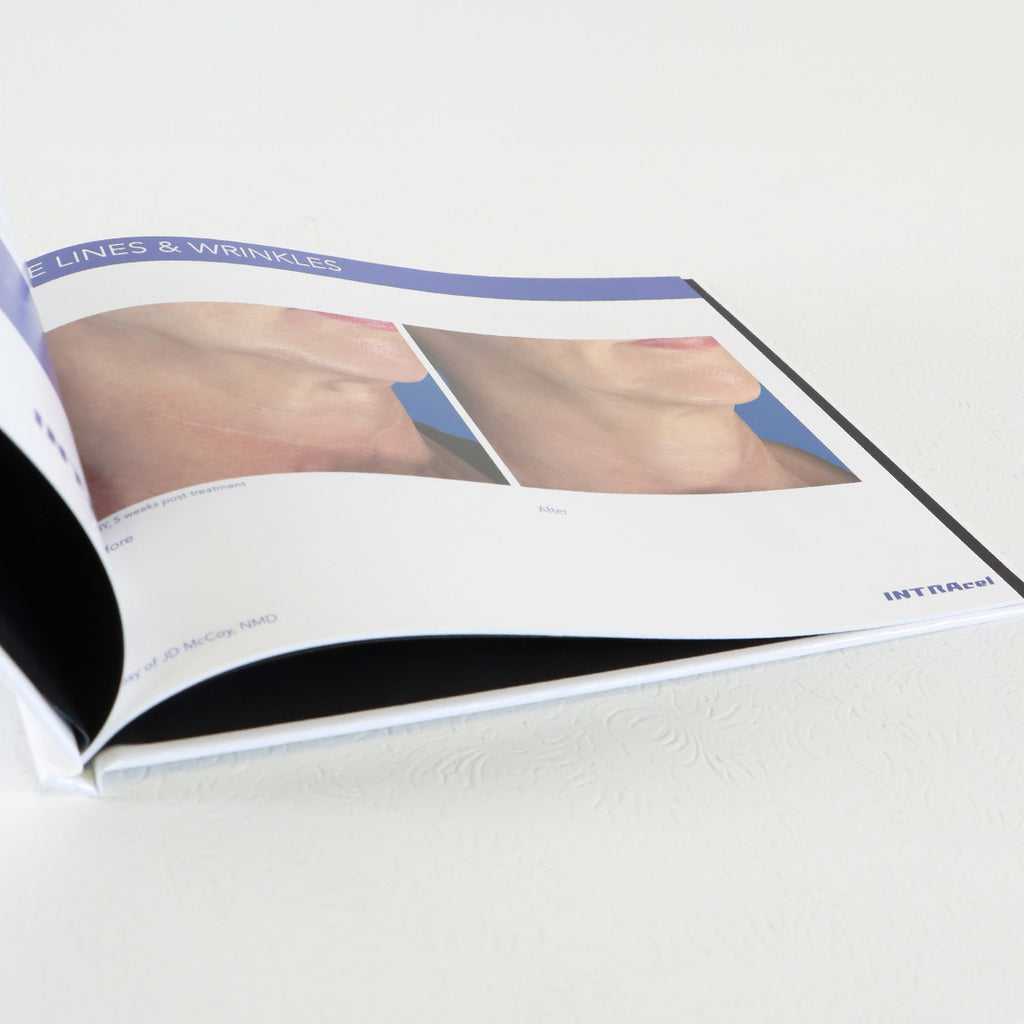 Jeisys INTRAcel Before After Patient Results 'Have Beautiful Skin' Book