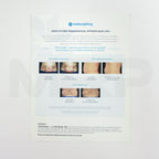 Zeltiq CoolSculpting Identifying Paradoxical Hyperplasia Guide