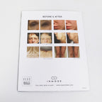 InMode Morpheus 8 RF Microneedling Marketing Information Trifold