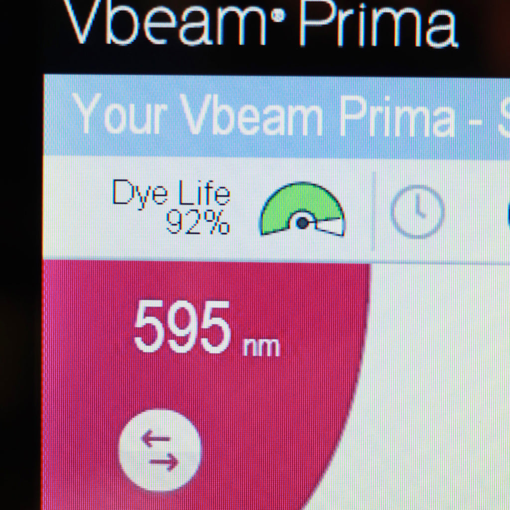 2019 Candela VBeam Prima Pulsed Dye Laser PDL System