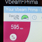 2019 Candela VBeam Prima Pulsed Dye Laser PDL System