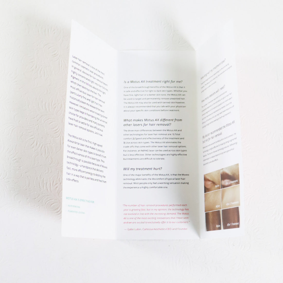 DEKA Motus AX Laser Hair Removal Office Patient Brochure x15