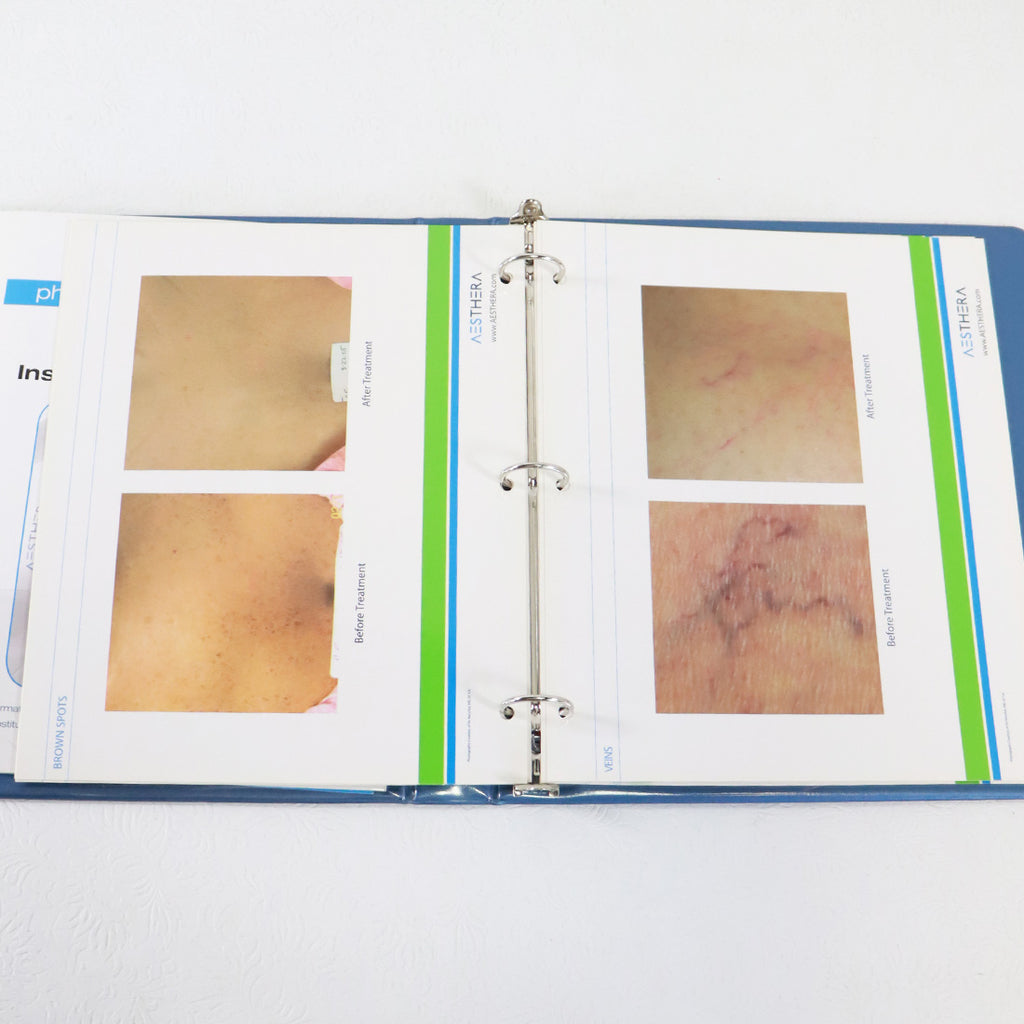 Aesthera PPx Painless Treatments Marketing Binder 40-00738-AA