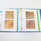 Aesthera PPx Painless Treatments Marketing Binder 40-00738-AA