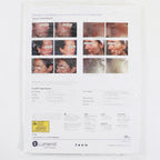 2020 Lumenis Stellar M22 Information Marketing Flyer PB-00002780 Rev A 25x