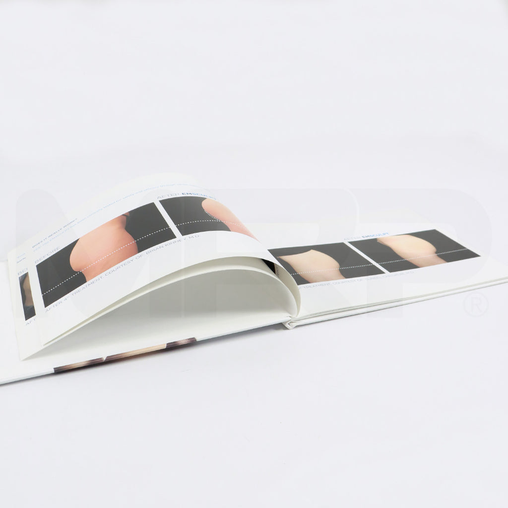 BTL EMsculpt Build Muscle & Sculpt Your Body Marketing Patient Photos Book