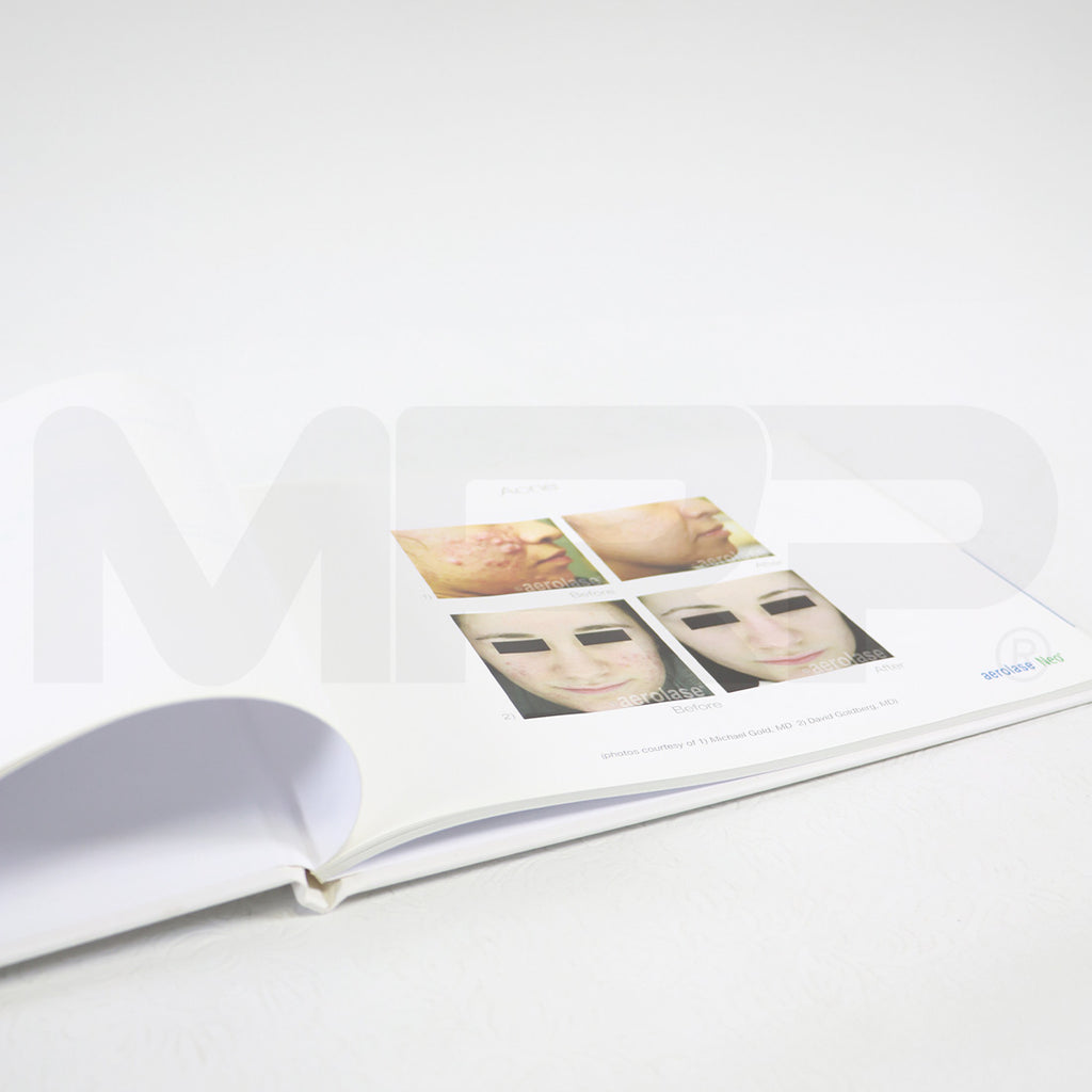 Aerolase Neo Aesthetic Laser Treatment Office Marketing Before After Photos Book