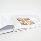 Aerolase Neo Aesthetic Laser Treatment Office Marketing Before After Photos Book