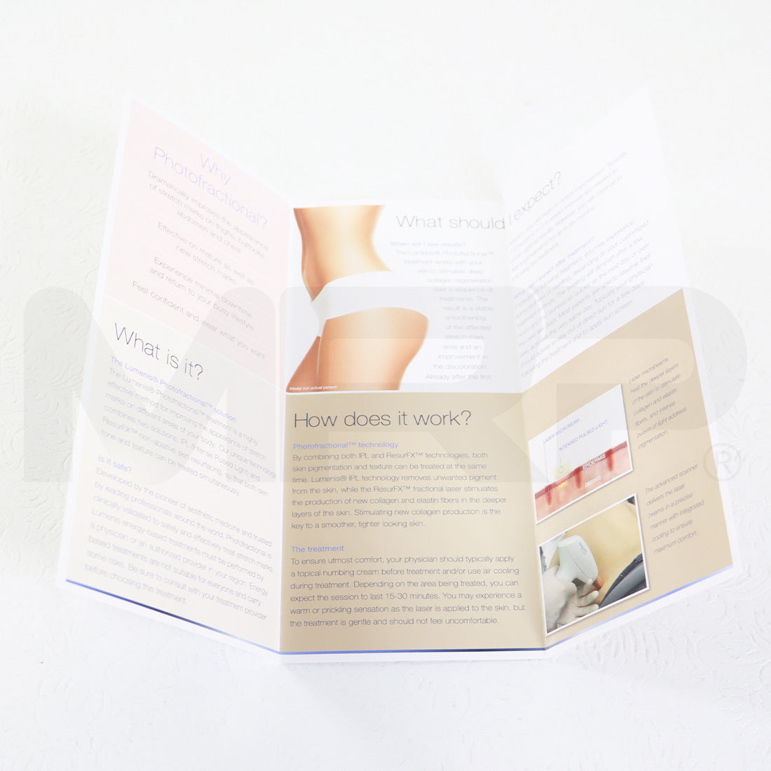 Lumenis Photofractional For Stretch Marks Marketing Brochures x22 Pack