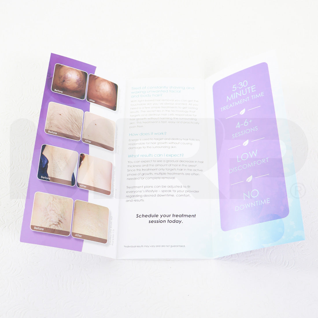 Cynosure Uncover Touchable Skin Laser Hair Removal x67 Pack
