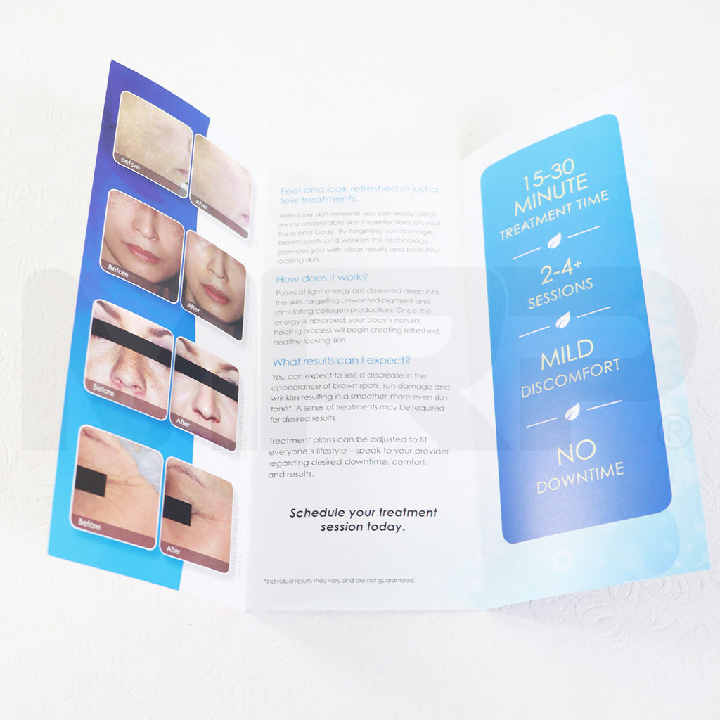 Cynosure Refresh Your Skin Laser Skin Renewal