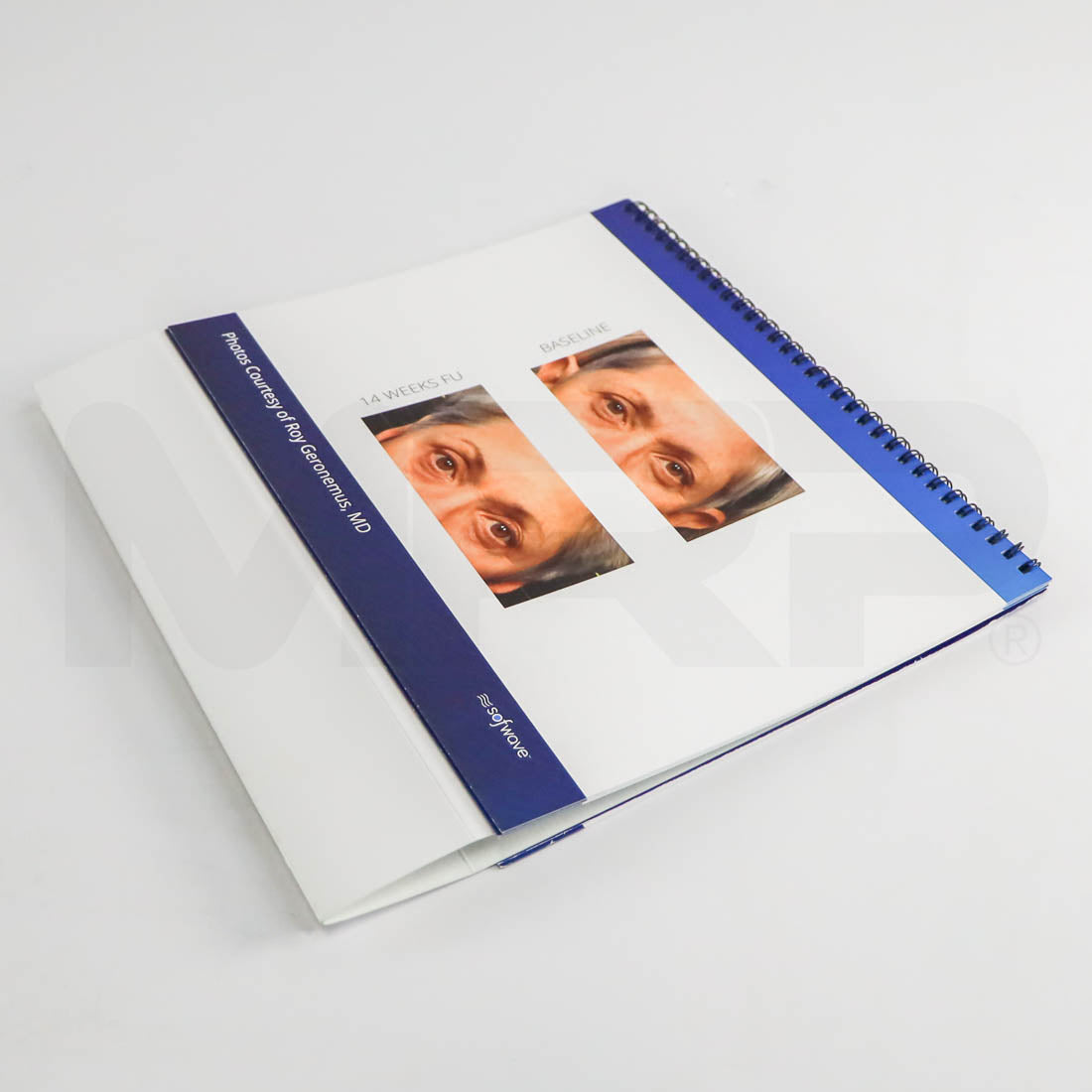 Sofwave Regenerative Aesthetics Company Before & Afters Marketing Booklet Inside