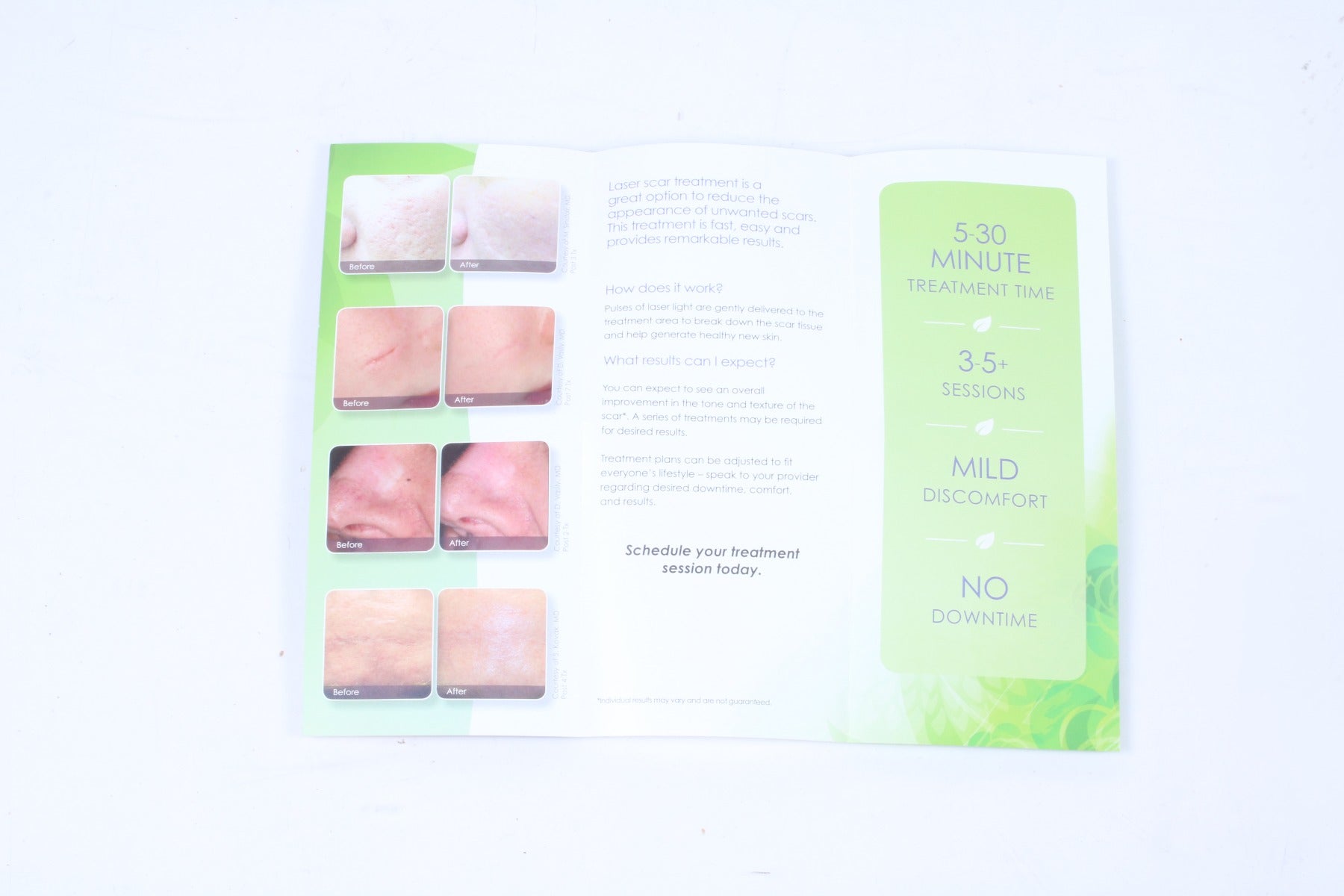 Cynosure Feel Confident Laser Scar Removal Patient Brochures 5 Pack 2015