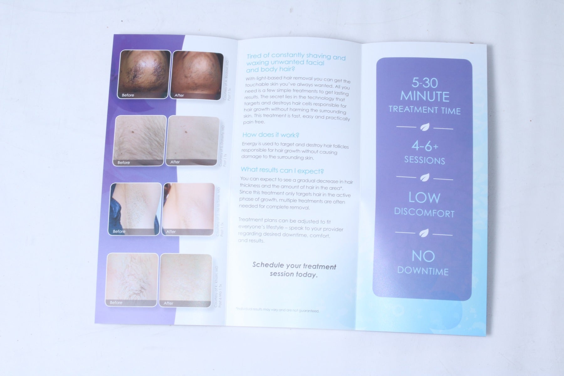 Cynosure Uncover Touchable Skin Laser Hair Removal Patient Brochures 56Pack 2015