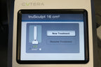 2012 Cutera TruSculpt Radio Frequency Cellulite Reduction Contour Sculpt 60 Tx