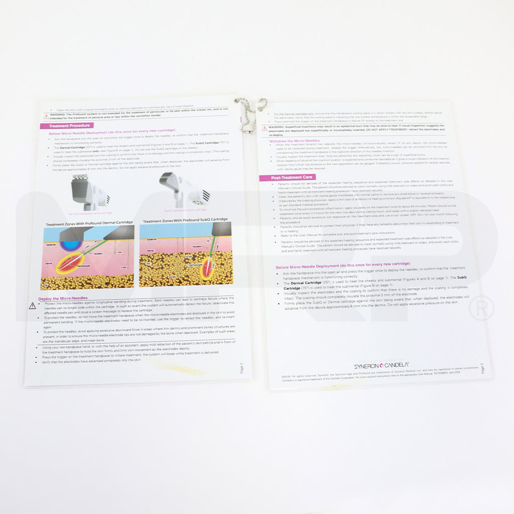 Syneron Candela Profound Quick Reference Guide Basic Protocol 04/2016