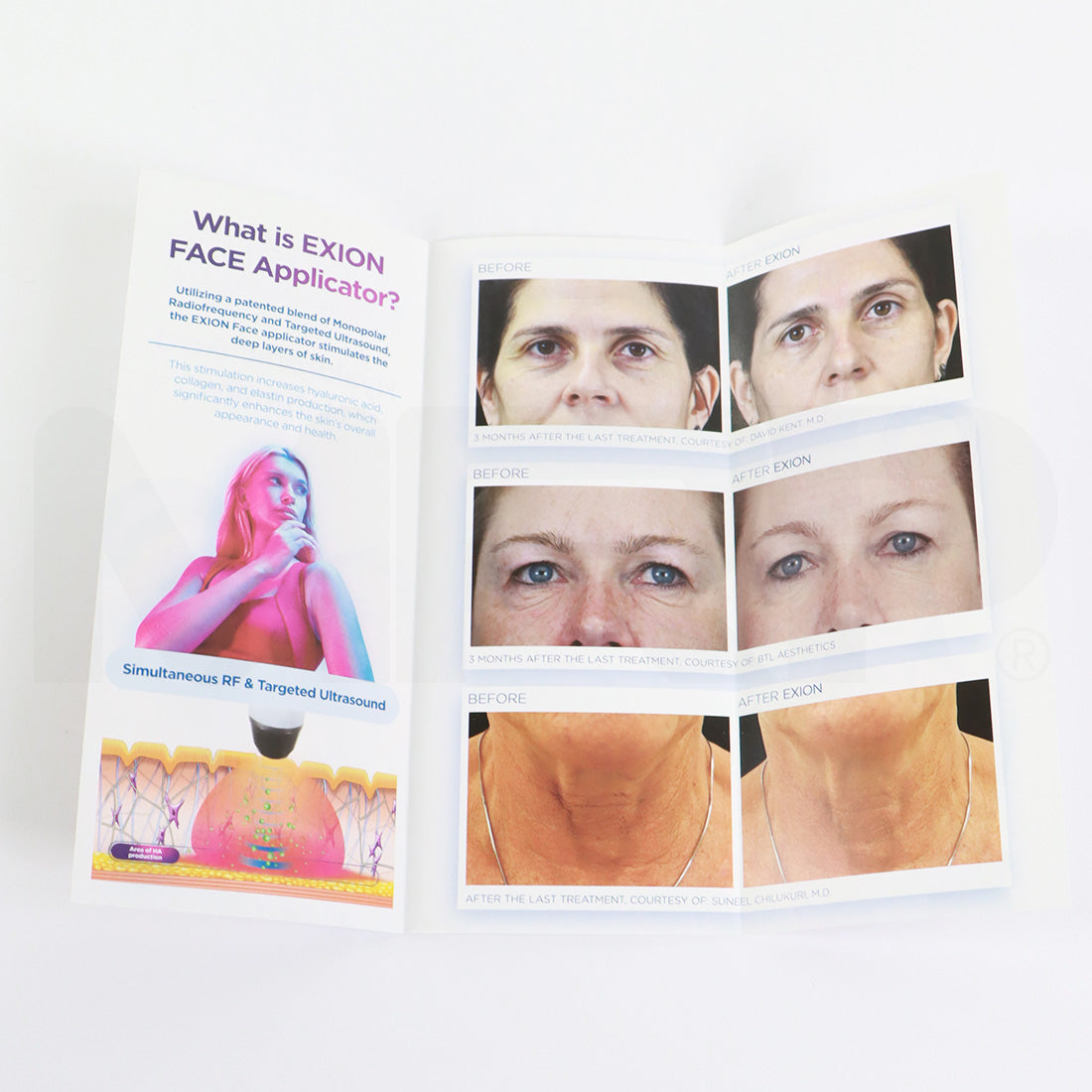 BTL Exion Face Applicator Educational Office Marketing Brochures x100 Pcs