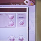 2007 Candela VBeam Perfecta Pulsed Vascular Acne Vein Laser System