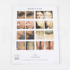 InMode Morpheus 8 Sales Brochure (50x)