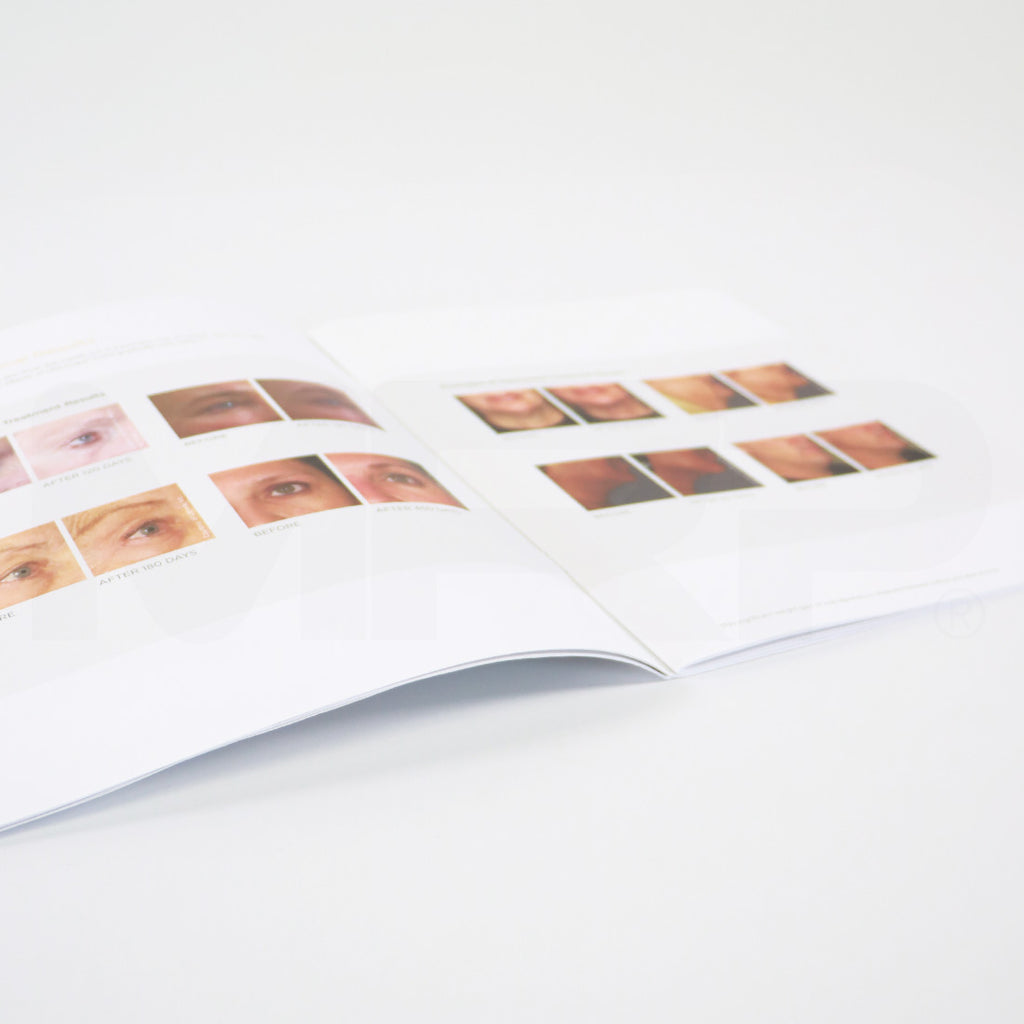 Merz Ultherapy Customer Training Guide Manual Book 1005835