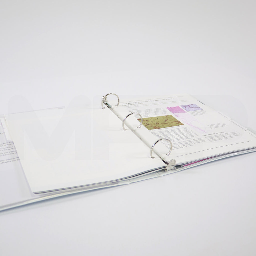 Syneron Candela UltraShape Quick Reference Guide