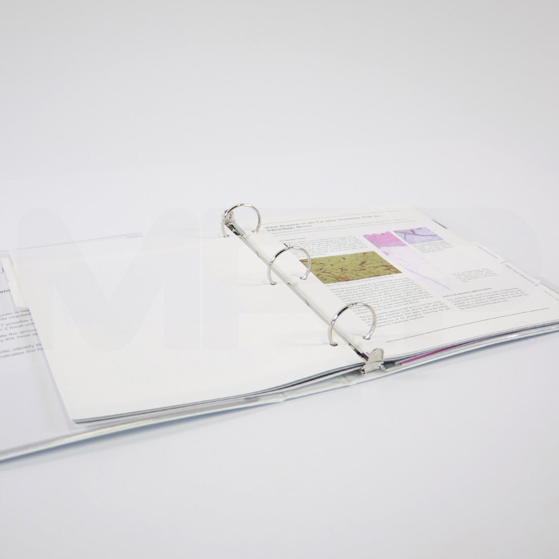Syneron Candela UltraShape Quick Reference Guide
