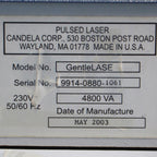 2003 Candela GentleLase Mini Pulsed Laser Alexandrite MGL 755nm Gentle Lase