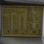 2004 Candela GentleYag Nd: YAG Laser Workstation Hair Removal Vascular Lesions