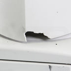 2001 Lumenis UltraPulse Encore CO2 Laser Skin Resurfacing Pigmentation System