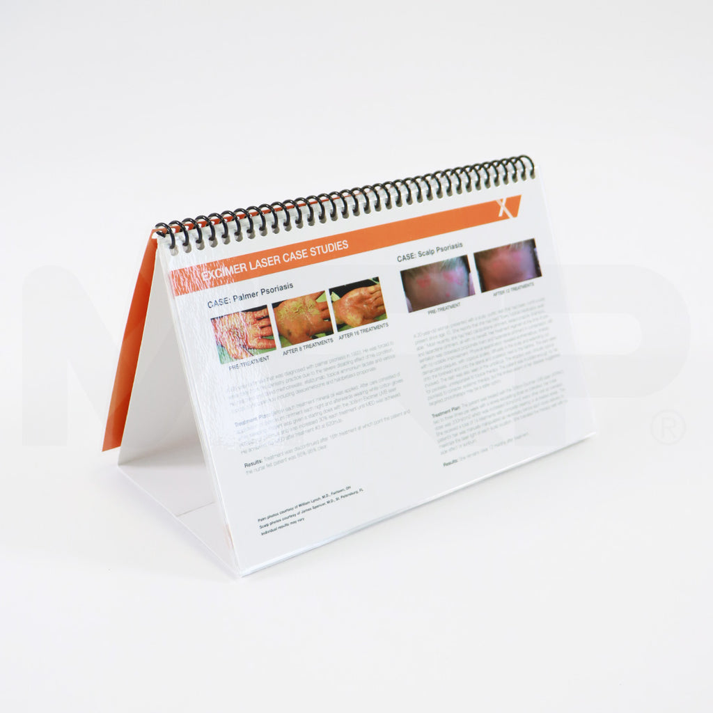 PhotoMedex XTRAC Psoriasis Vitiligo Before & After Booklet 12-95485-01 Rev B