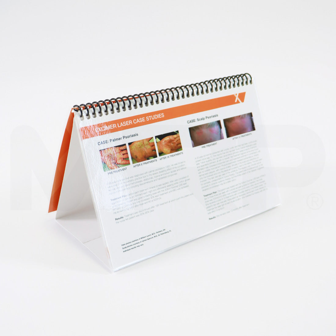 PhotoMedex XTRAC Psoriasis Vitiligo Before & After Booklet 12-95485-01 Rev B